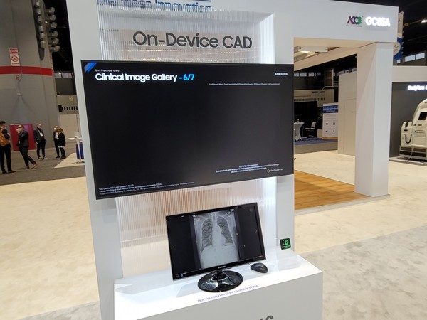 Samsung highlights its new On-Device (computer-assisted detection) CAD software to detect the five most common thoracic findings on X-ray images in emergency care.