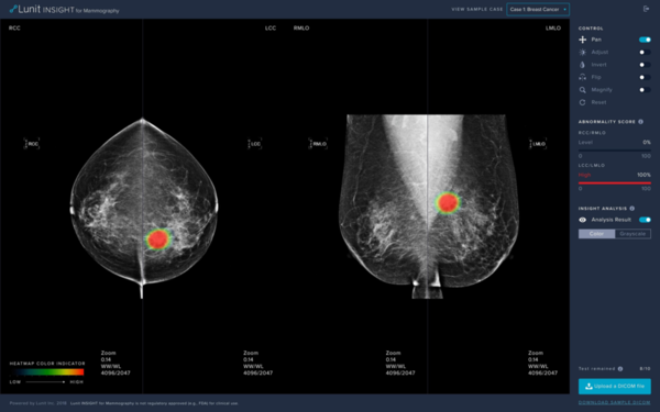 Lunit INSIGHT MMG, an AI solution for mammography (Credit: Lunit)