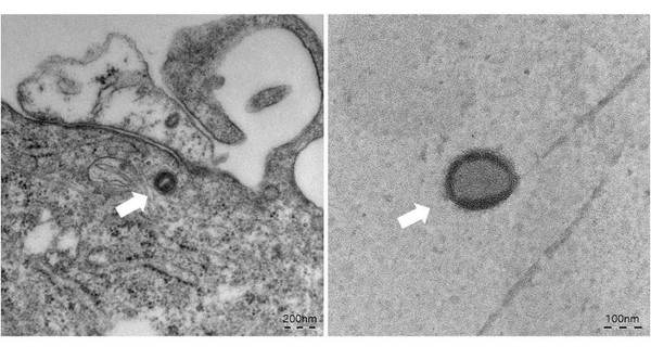 Electronic microscopic photos of the monkeypox virus (Credit: KDCA)