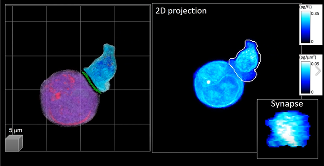 The 3D holographic video footage analyzed with AI-based tech is shown. (left)  The blue color is the CAR-T cell, and purple is the targeted cancer cell. The picture on the right is the 2D projection.