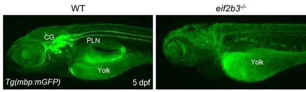 Zebrafish that lacked the EIF2B3 gene (left) showed deficiency in myelin production compared to the healthy group. (Severance)
