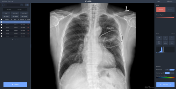 A screenshot of VUNO’s lung X-ray reading assistance solution VUNO Med-Chest X-ray (Credit: VUNO)