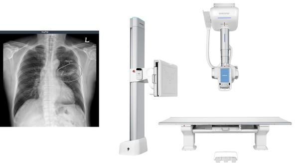 Vuno has agreed to install its AI system on Samsung Electronics’  ceiling-fixed digital X-ray system.