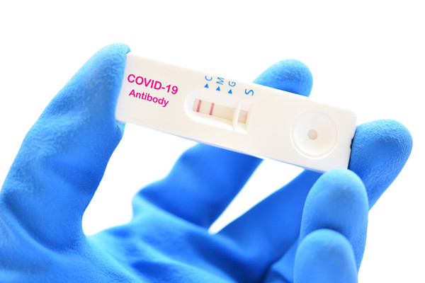 Home Covid-19 antibody testing kits were unreliable and ineffective, the Korean Society for Laboratory Medicine said.