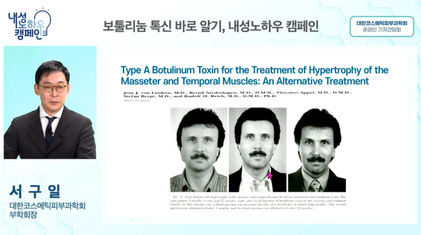 Korean Society for Cosmetic Dermatology Vice Chair Seo Koo-il pointed to the gap in the perception of tolerance of botulinum toxin between health providers and patients, emphasizing the need for active consultation, in an online conference Wednesday.