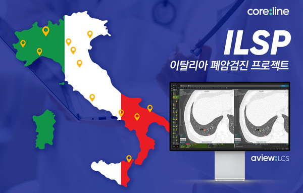 Coreline Soft fornirà la sua soluzione toracica AI, vista: LCS, agli ospedali italiani che stanno conducendo un progetto di screening del cancro del polmone.