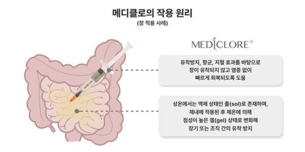 The picture illustrates the working mechanism of CG Bio’s Mediclore. Anti-adhesion, antibacterial and hemostatic factors help the intestines recover quickly without adhesion and inflammation. It is a liquid solution at room temperature but changes to a highly viscous gel inside the body to prevent adhesion between organs or tissues.