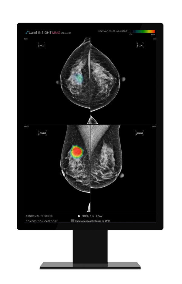 Lunit has received approval for its AI-based imaging analysis solution from the Canadian regulator.