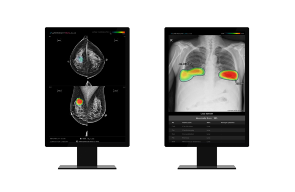 Lunit plans to present five abstracts featuring its AI solutions for chest and breast radiology at the ECR 2022.