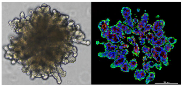 These are three-dimensional organoids cultured by researchers at Gangnam Severance Hospital using salivary epithelial stem cells.