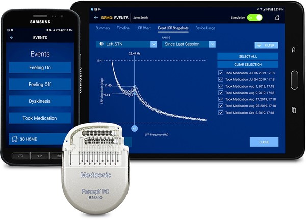 Medtronic's deep brain stimulator (DBS), Percept PC , recently launched in Korea and has also applied for insurance benefits.