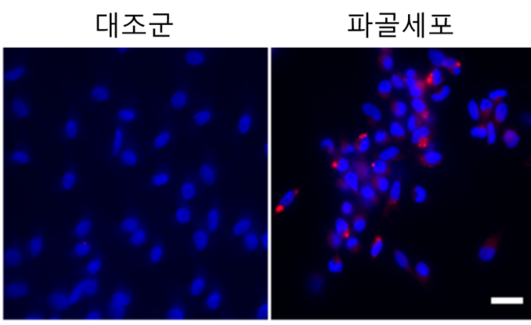 The pictures show the appearance of NFACT1 superenhancer RNA (red part). (Courtesy of UNIST)