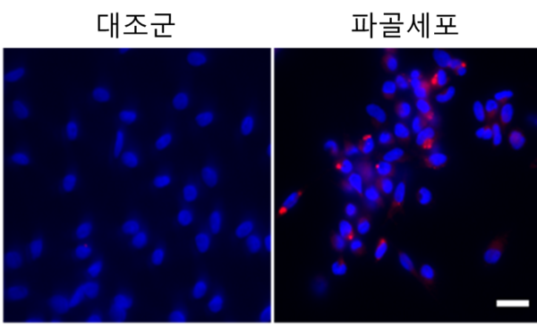 The pictures show the appearance of NFACT1 superenhancer RNA (red parts). (Courtesy of UNIST)