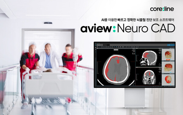 Coreline Soft's brain hemorrhage image detection and diagnosis assistance software, AVIEW NeuroCAD, obtained domestic approval from the Ministry of Food and Drug Safety (MFDS).
