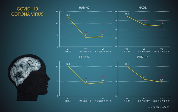 The diagram shows the improvement after applying MINDD STIM in Covid-19 brain fog patients where V1 is before treatment, V2 is immediately after treatment, and V3 is two weeks after the end of treatment.  (Credit: Ybrain)