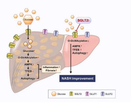 The diagram shows a novel regulatory pathway in the progression of NASH . (Source: Metabolism)