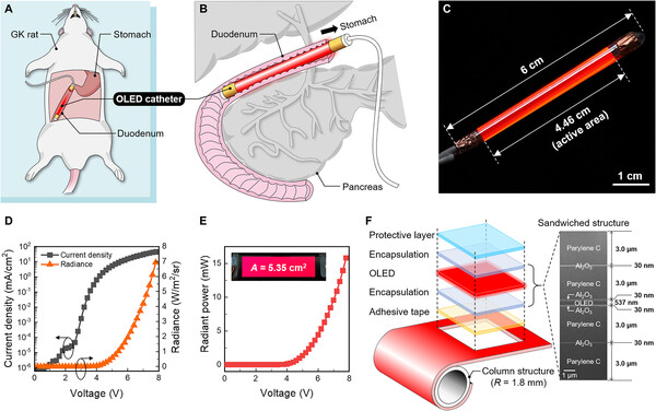 Overview of the proposed OLED catheter.Schematic diagrams of (A) the phototherapy process proposed in this study and (B) an OLED catheter inserted into the duodenum of a GK rat. (C) A photograph of the actual light emission of the OLED catheter. (D) The current density (J)–voltage (V)–radiance (R) and (E) radiant power characteristics of the OLED catheter. (F) Overall configuration of the OLED catheter and focused ion beam scanning electron microscope cross-sectional image of the flexible OLED. (Courtesy of Science Advances)