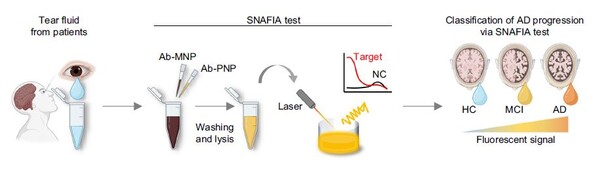 When the team utilized self-assembled nanoparticle-mediated amplified fluorogenic immunoassay (SNAFIA) on clinical tear samples, the fluorescent signal values indicating the presence of CAP1 protein progressively increased with disease progression in the order of normal (HC), mild cognitive impairment (MCI), and Alzheimer's disease (AD). (Source: Yongin Severance Hospital)