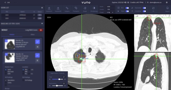 VUNO Med-Lung CT AI's operation screen (Credit: VUNO)
