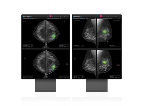 Lunit signed its first supply contract for the recent FDA-approved Lunit INSIGHT DBT, its 3D breast cancer detection AI solution, with Mosaic Breast Imaging.