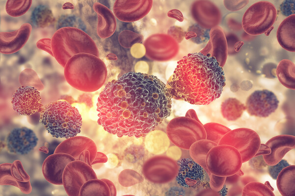 CAR-T therapy, often referred to as the dream cancer drug, is used to treat patients with cancers for which there are no other treatments, with at least two-thirds of patients being cured completely. (Credit: Getty Images)