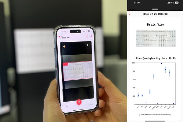 ECG Buddy, a medical artificial intelligence, analyzes images of electrocardiogram results on a smartphone without any equipment and helps diagnose emergency diseases. (Courtesy of SNUBH)