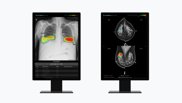 Lunit INSIGHT CXR (left), an AI image analysis solution for chest X-rays, and Lunit INSIGHT MMG, an AI image analysis solution for mammograms (Courtesy of Lunit)