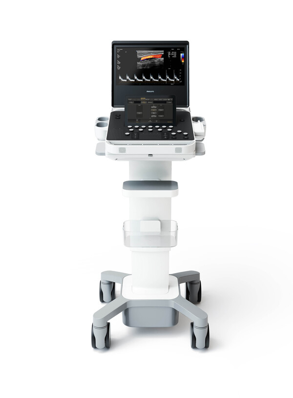 Philips Korea’s Compact 5500 mobile ultrasound machine