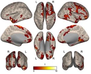 SNUH's sudy reveals age-related changes in brain function of children ...