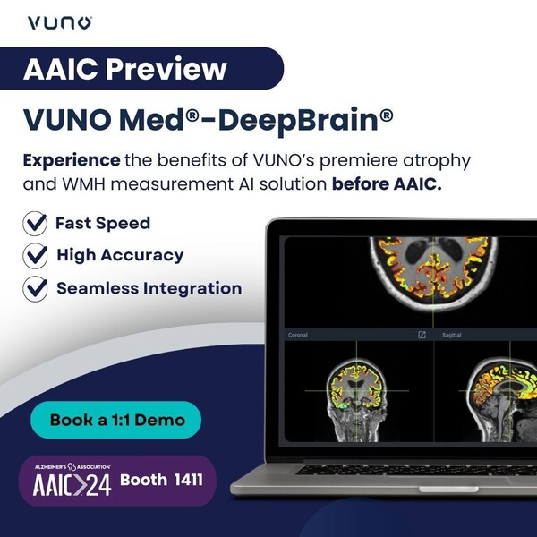 VUNO to launch AIbacked dementia detecting device at AAIC 2024 in US