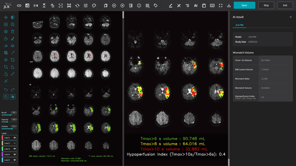 JLK seeks FDA clearance for MR brain perfusion imaging solution