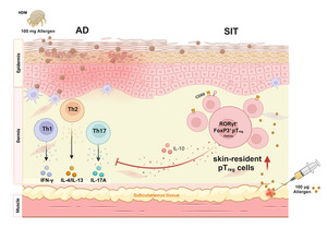 Key immune cell linked to allergy therapy success in atopic dermatitis ...