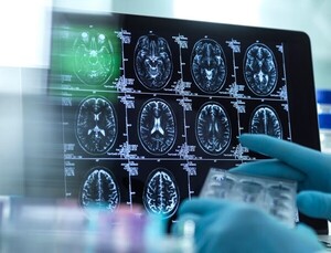 KDCA-backed BRIDGE data platform advances early detection research for dementia, Parkinson’s