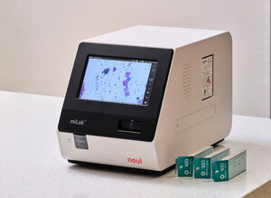 Noul expands into Mexico with AI-based cervical cancer diagnostic miLab CER