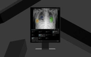 Lunit breaks into Korea’s outsourced radiology market with teleradiology supply deals