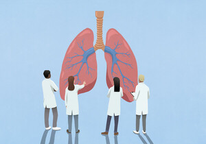 Chronic lung disease triples lung cancer risk in non-smokers: Korean study < Hospital < Article