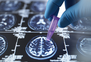 Early diagnosis push meets cost reality in Korea’s dementia overhaul