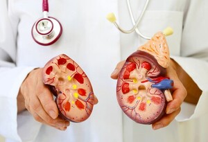 1 in 4 Koreans aged 70 or older has chronic kidney disease: KDCA